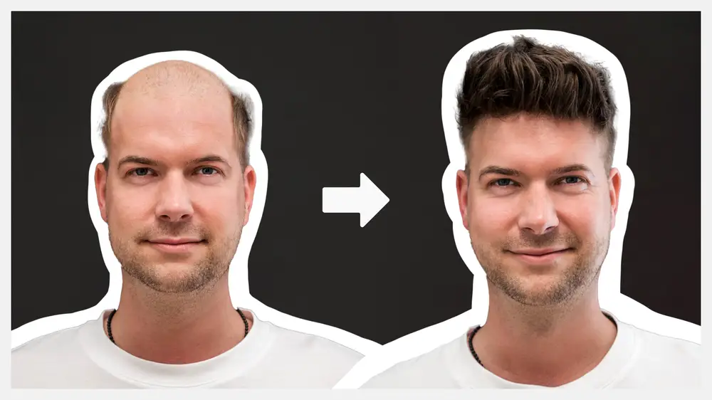 Hairsystem Vorher & Nachher ↔️ | Haarersatz für Männer