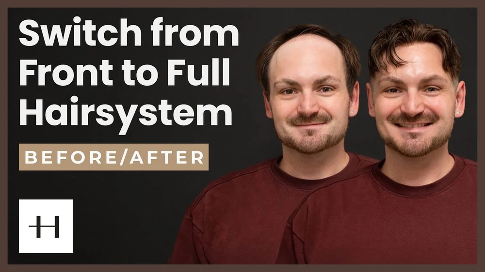 Irgendwann reicht ein Frontsystem nicht mehr... | Adrian's Transformation | Hairsystems Heydecke