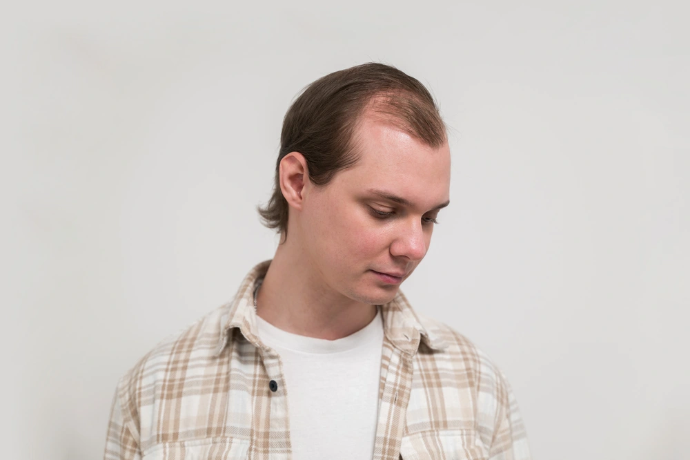 Effektive Behandlungen und Pflegetipps für dünner werdende Haare