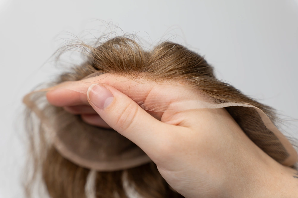 alopecia-areata-ursachen-und-moegliche-ausloeser